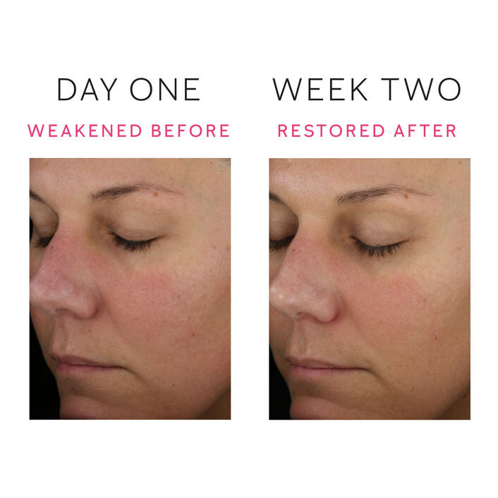 Mary Kay Clinical Solutions® Barrier Restore 1:1:3